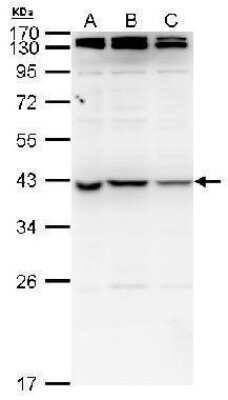 Western Blot: NME7 Antibody [NBP2-42888]