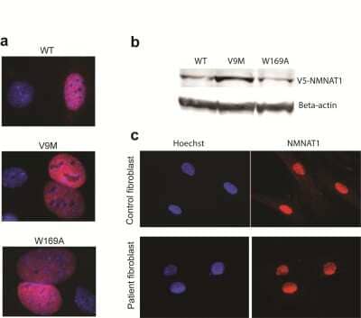 Immunocytochemistry/ Immunofluorescence: NMNAT-1 Antibody [H00064802-B01P]