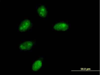 Immunocytochemistry/ Immunofluorescence: NMNAT-1 Antibody [H00064802-B01P]