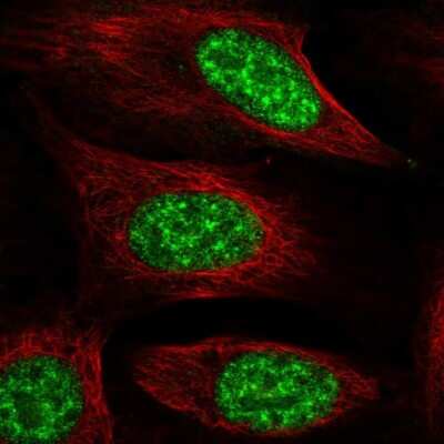 Immunocytochemistry/ Immunofluorescence: NMNAT-1 Antibody [NBP2-32464]