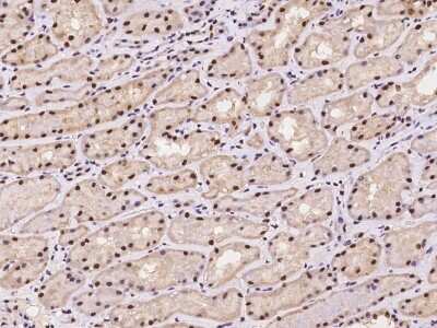 Immunohistochemistry-Paraffin: NMNAT-1 Antibody [NBP2-97227]
