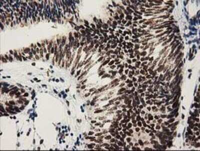 Immunohistochemistry: NMNAT-1 Antibody (OTI1G4) - Azide and BSA Free [NBP2-73017]