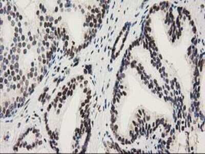 Immunohistochemistry: NMNAT-1 Antibody (OTI1G4) - Azide and BSA Free [NBP2-73017]