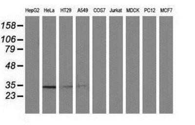 Western Blot: NMNAT-1 Antibody (OTI1G4)Azide and BSA Free [NBP2-73017]