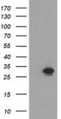 Western Blot: NMNAT-1 Antibody (OTI1G4)Azide and BSA Free [NBP2-73017]