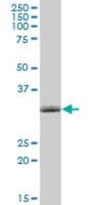 Western Blot: NMNAT-1 Antibody [H00064802-B01P]