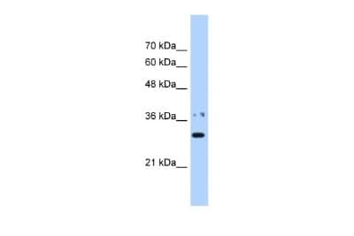 Western Blot: NMNAT-1 Antibody [NBP1-52973]