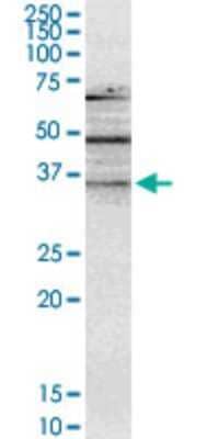 Western Blot: NMNAT-2 Antibody (4E6) [H00023057-M02]