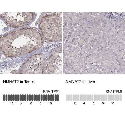 Immunohistochemistry-Paraffin: NMNAT-2 Antibody [NBP2-62637]