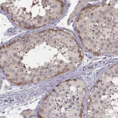 Immunohistochemistry-Paraffin: NMNAT-2 Antibody [NBP2-62637]