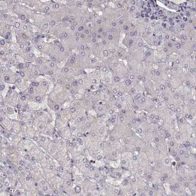 Immunohistochemistry-Paraffin: NMNAT-2 Antibody [NBP2-62637]