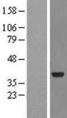 Western Blot: NMNAT-2 Overexpression Lysate [NBL1-13692]