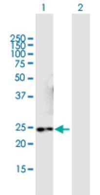 Western Blot: NMNAT3 Antibody [H00349565-B01P]