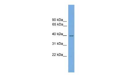 Western Blot: NMRAL1 Antibody [NBP2-87930]