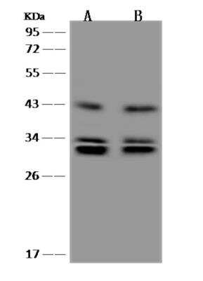 Western Blot: NMRAL1 Antibody [NBP3-06073]