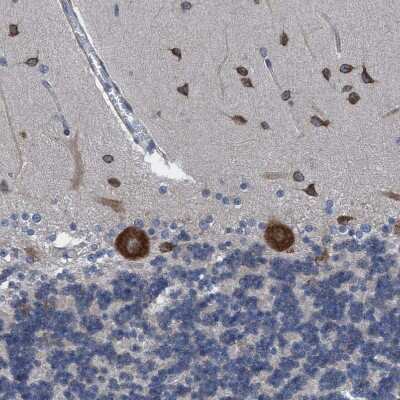 Immunohistochemistry-Paraffin: NMT1 Antibody [NBP1-82547]