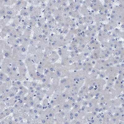 Immunohistochemistry-Paraffin: NMT1 Antibody [NBP1-82547]