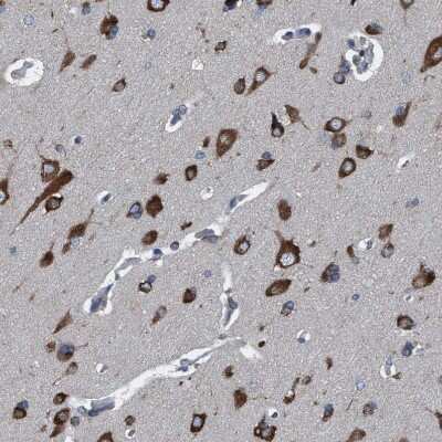Immunohistochemistry-Paraffin: NMT1 Antibody [NBP1-82547]