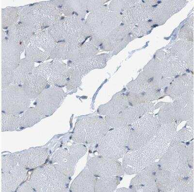Immunohistochemistry-Paraffin: NMT1 Antibody [NBP1-82547]
