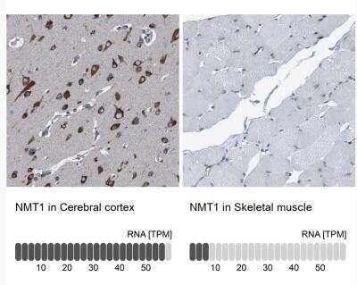 Immunohistochemistry-Paraffin: NMT1 Antibody [NBP1-82547]