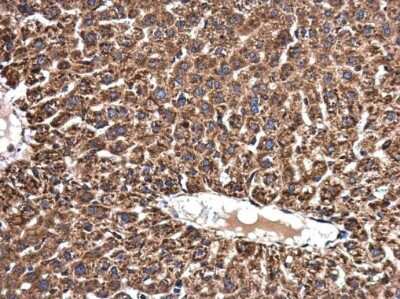 Immunohistochemistry-Paraffin: NMT1 Antibody [NBP3-12963]