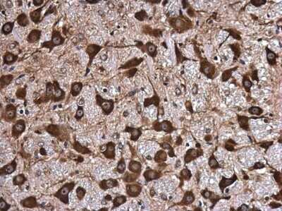 Immunohistochemistry-Paraffin: NMT1 Antibody [NBP3-12963]