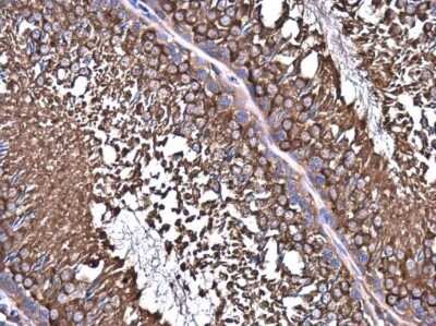 Immunohistochemistry-Paraffin: NMT1 Antibody [NBP3-12963]