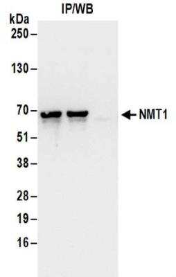 Immunoprecipitation: NMT1 Antibody [NBP2-32167]