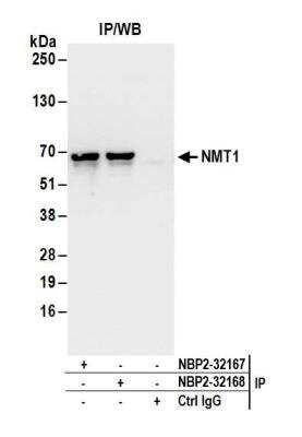 Immunoprecipitation: NMT1 Antibody [NBP2-32168]