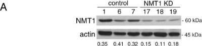 Knockdown Validated: NMT1 Antibody [NBP2-32168]
