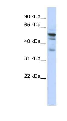 Western Blot: NMT1 Antibody [NBP1-54379]