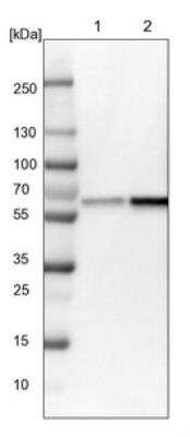 Western Blot: NMT1 Antibody [NBP1-82547]