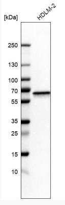 Western Blot: NMT1 Antibody [NBP1-82547]