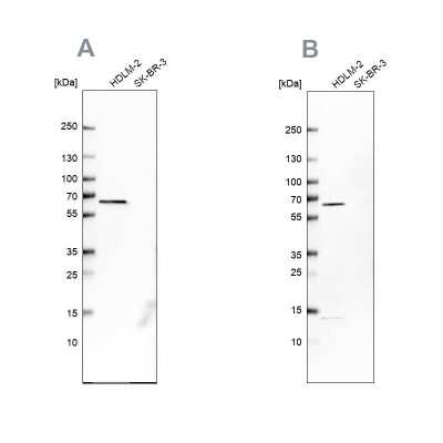 Western Blot: NMT1 Antibody [NBP1-82547]