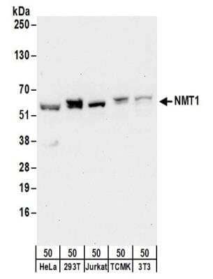 Western Blot: NMT1 Antibody [NBP2-32167]