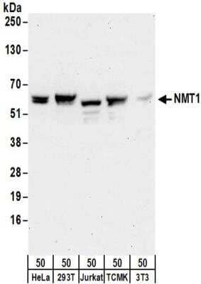 Western Blot: NMT1 Antibody [NBP2-32168]