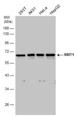 Western Blot: NMT1 Antibody [NBP3-12963]