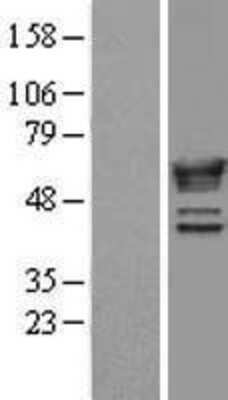 Western Blot: NMT1 Overexpression Lysate [NBL1-13694]