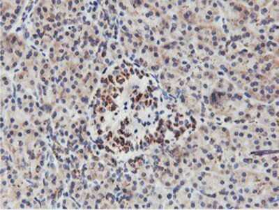 Immunohistochemistry-Paraffin: NMT2 Antibody (OTI1G3) [NBP2-01676]