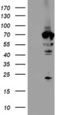 Western Blot: NMT2 Antibody (OTI1G3) [NBP2-01676]