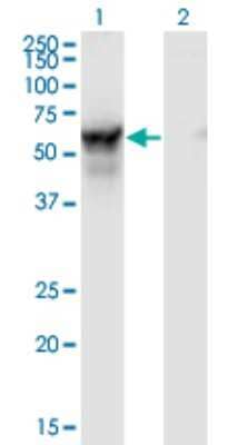 Western Blot: NMT2 Antibody (2E12-4B5) [H00009397-M01]