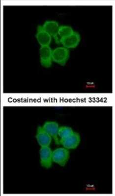 Immunocytochemistry/ Immunofluorescence: NMT2 Antibody [NBP2-19555]