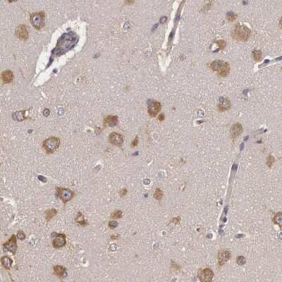 Immunohistochemistry-Paraffin: NMT2 Antibody [NBP1-85817]