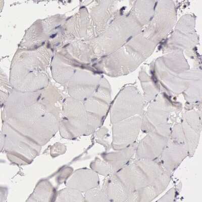 Immunohistochemistry-Paraffin: NMT2 Antibody [NBP1-85817]