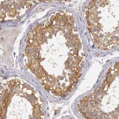 Immunohistochemistry-Paraffin: NMT2 Antibody [NBP1-85817]