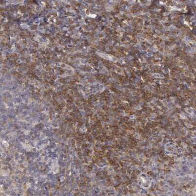 Immunohistochemistry-Paraffin: NMT2 Antibody [NBP1-85817]