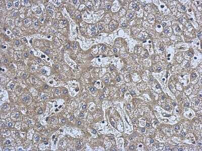 Immunohistochemistry-Paraffin: NMT2 Antibody [NBP2-19555]