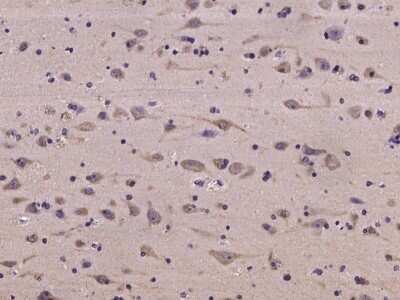 Immunohistochemistry-Paraffin: NMT2 Antibody [NBP2-97228]