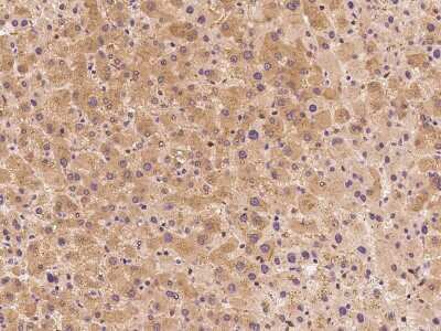 Immunohistochemistry-Paraffin: NMT2 Antibody [NBP2-99170]