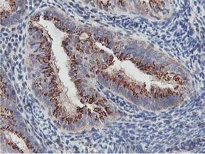 Immunohistochemistry: NMT2 Antibody (OTI1G3) - Azide and BSA Free [NBP2-73021]